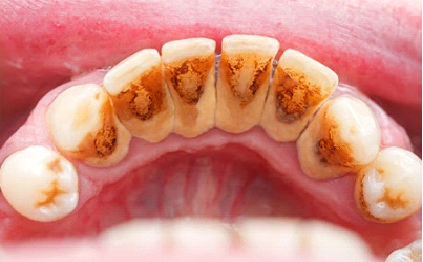 Эстетическая стоматология и протезирование зубов