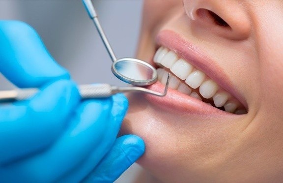О протезировании зубов