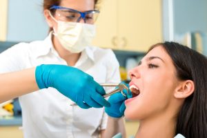 Удаление зуба: Когда Вам нужно удалить зуб?