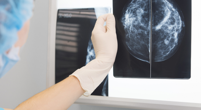 AI-платформа для анализа маммограмм