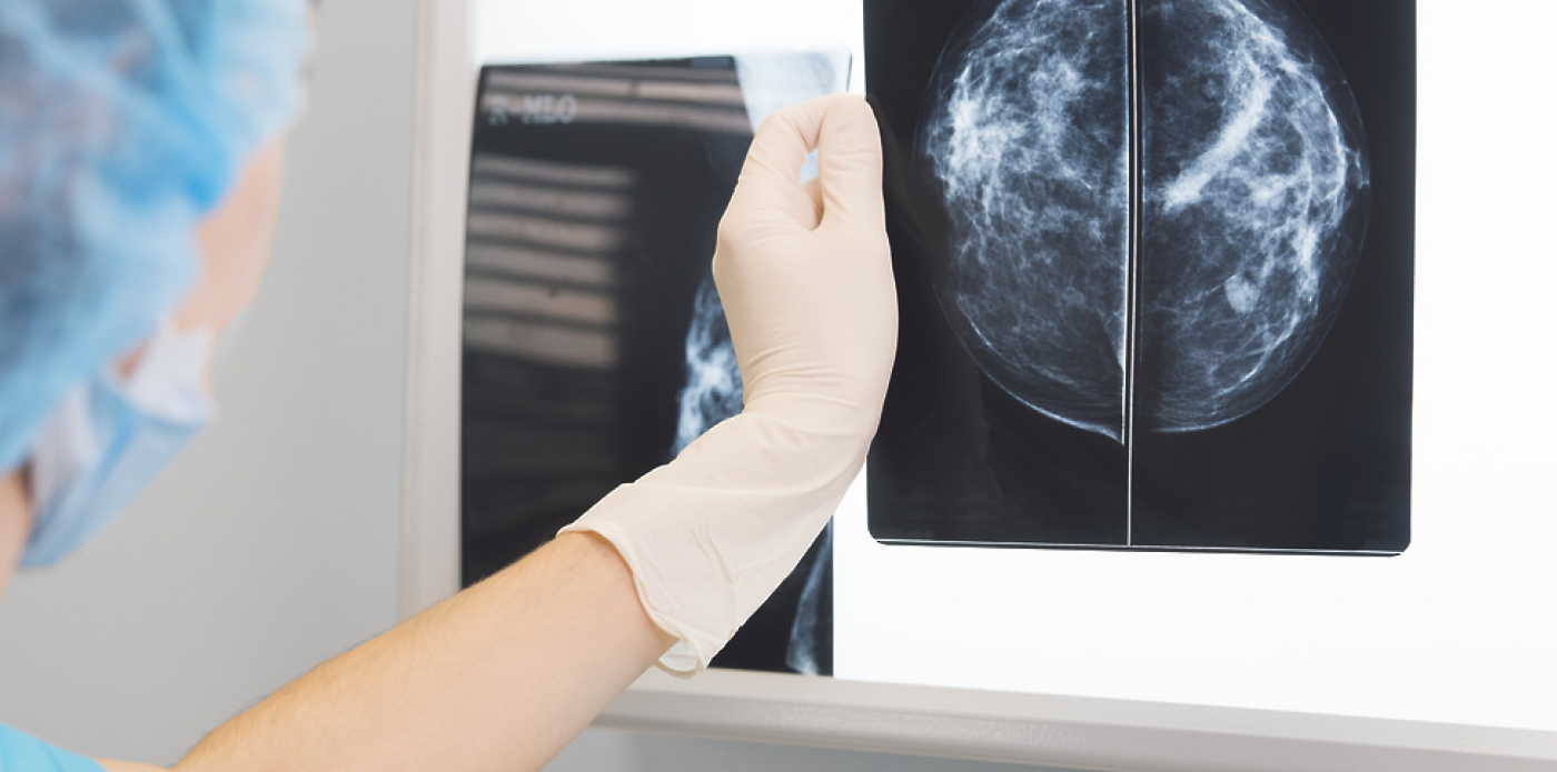 AI-платформа для анализа маммограмм