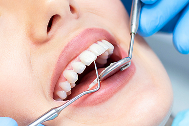Особенности лечения зубов