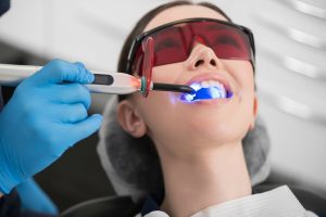 Отбеливание зубов: эффективные методы и безопасные приемы для сияющей улыбки