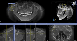 Современные методы томографии для диагностики заболеваний челюстно-лицевой области